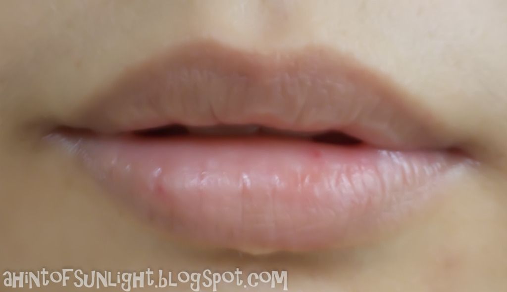 Lip Bumps